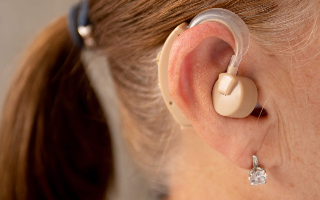 Adaptación de Audífonos: Soluciones Personalizadas para Mejorar tu Audición